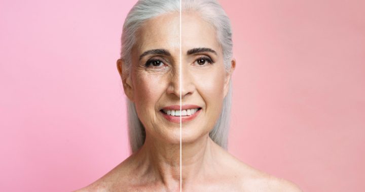 Colágeno Verisol: diferenças para o colágeno comum